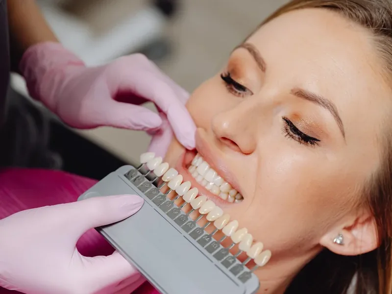 Dentist matching a tooth shade guide to a patient's smile